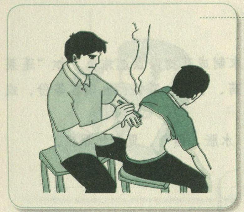 雷火神針灸